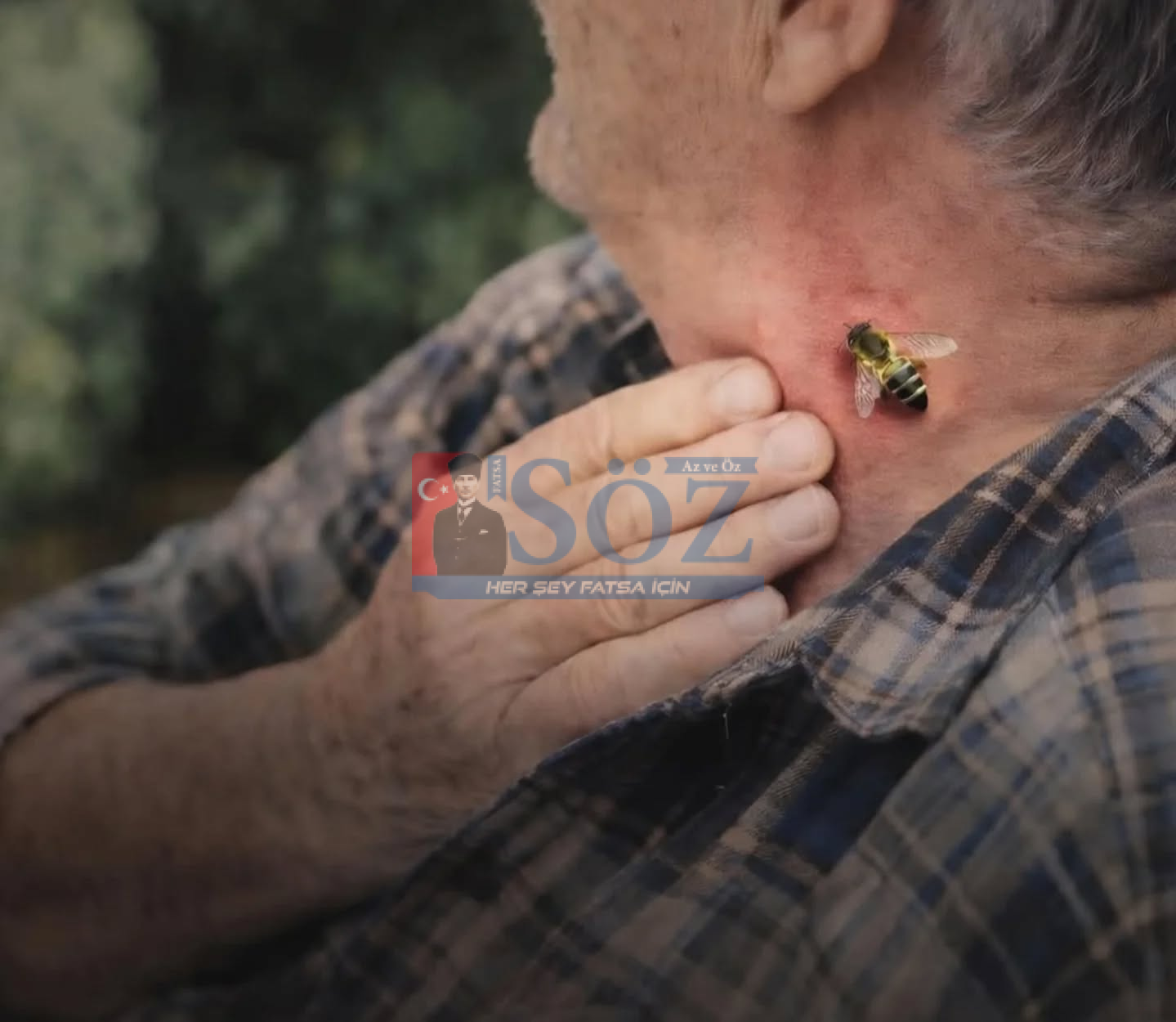 Arı Sokması Can Aldı